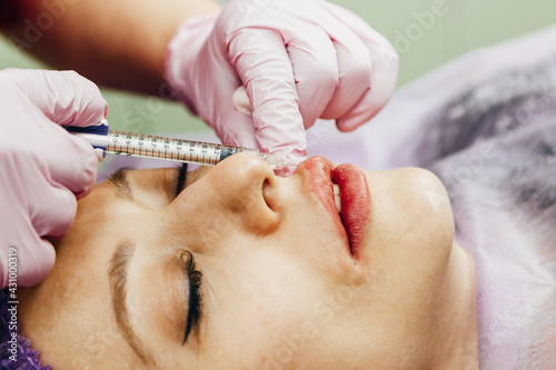 Valokuva Woman gets an injection with hyaluronic acid as a dermal filler for lip enlargem