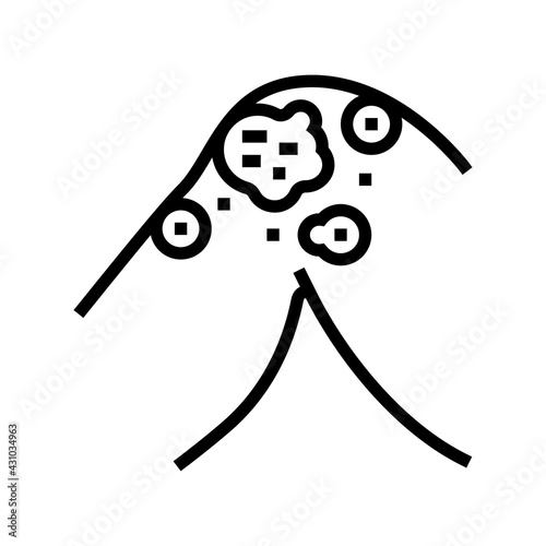 atopic dermatitis line icon vector. atopic dermatitis sign. isolated contour symbol black illustration