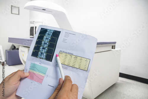 (BMD) DEXA densitometry spine scan. Osteopenia present, frequent precursor to osteoporosis on pen point on Bone density machine background .Medical healthcare concept. photo