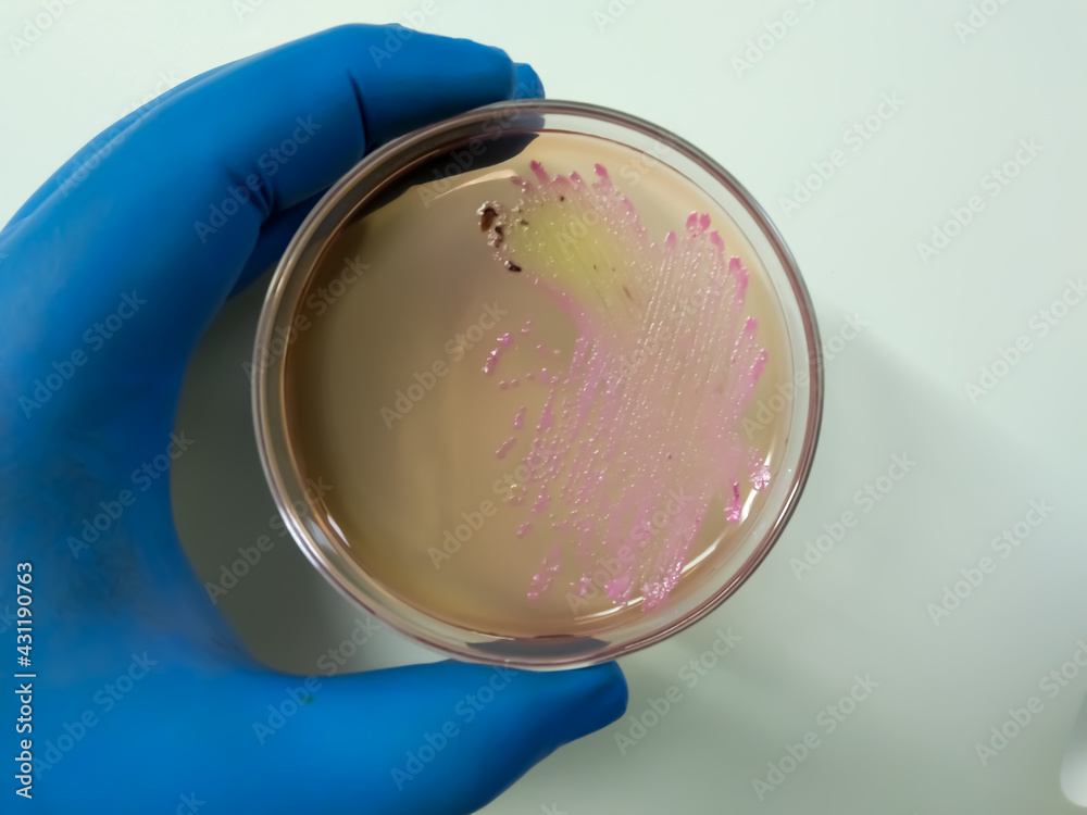 Photo &amp; Art Print Salmonella colonies on ss agar, salmonella black ...