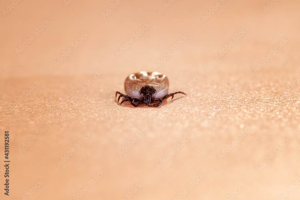 Obraz premium Engorged tick on a human skin. Lyme disease caused by borrelia.