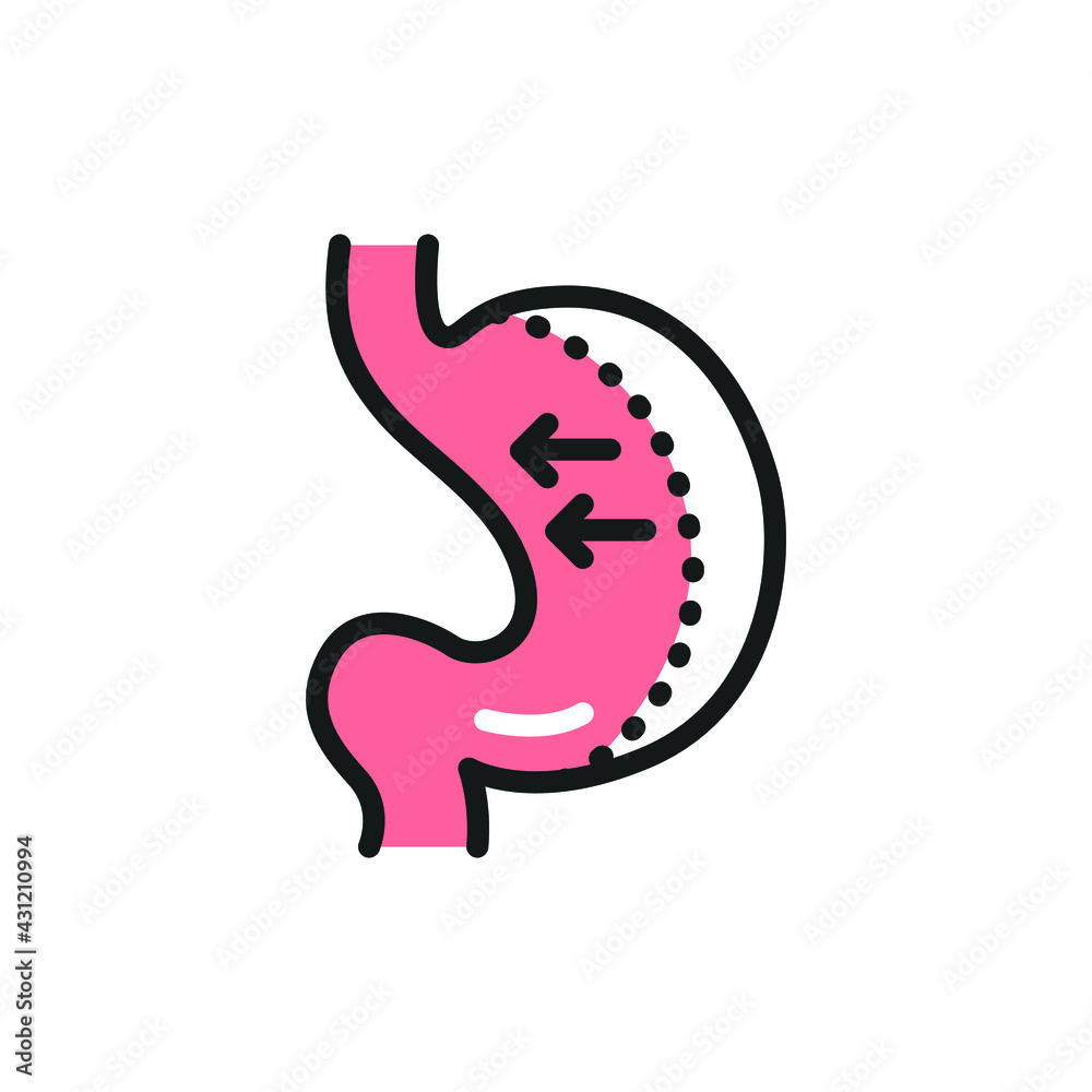 Sleeve gastrectomy color line icon. Isolated vector element. Outline pictogram for web page, mobile app, promo