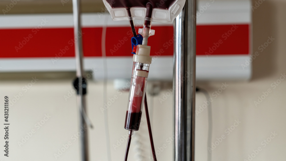 Ankara, Turkey - March 2021: Blood transfusion serum in hospital room with blood drip