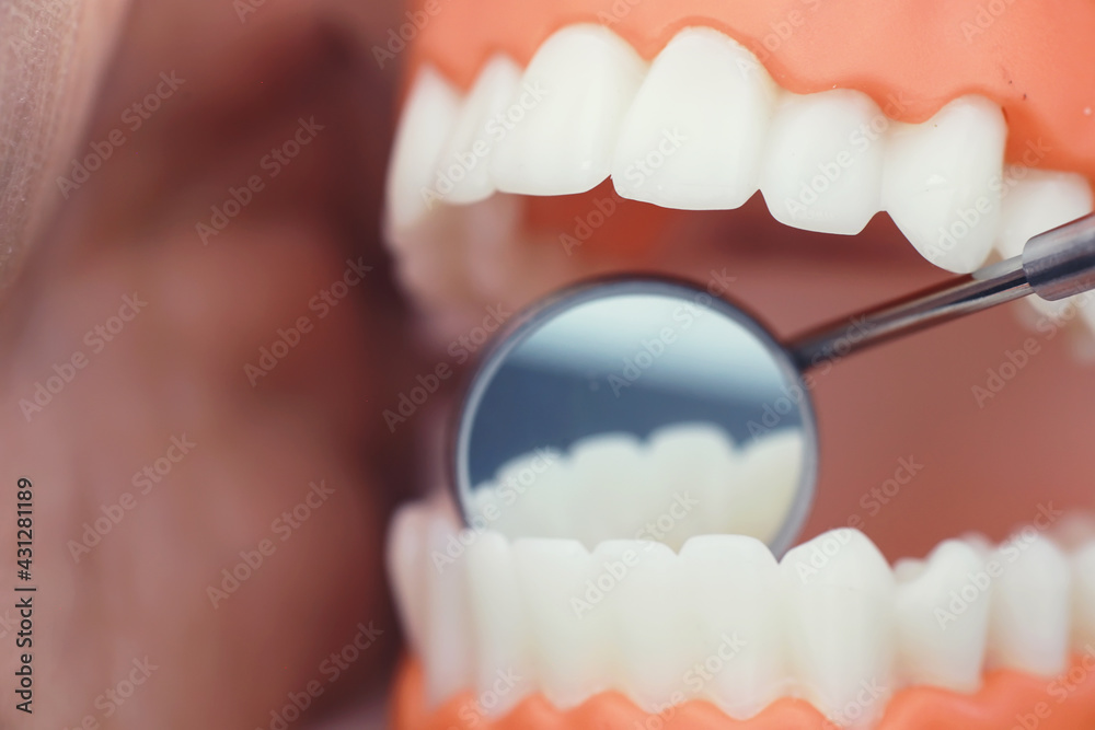Fototapeta premium Dentist's office. Dentist examines the oral cavity before treatment. The doctor shows a course of treatment. Caries jaw treatment. Implantation and installation of veneers.