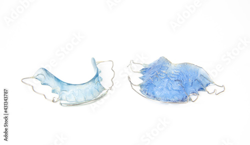 Blue Retainer with calculus or tartar stick on retainer on white background, isolated. Dental health or braces teeth care concept. Clean concept.