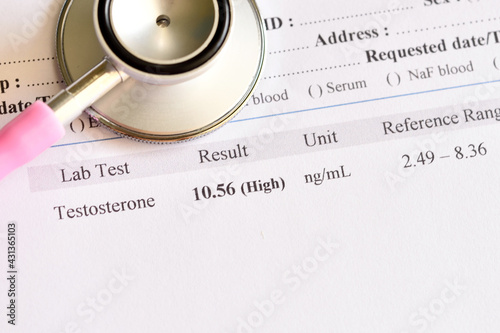 Bild auf Leinwand Abnormal high testosterone hormone test result with stethoscope