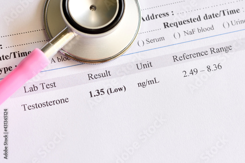 Abnormal low testosterone hormone test result with stethoscope