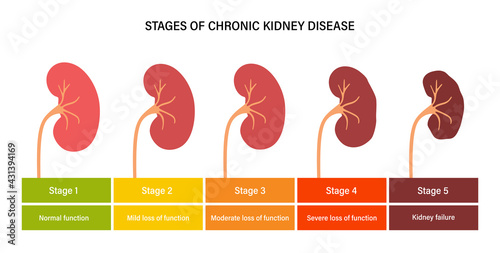 Kidney disease concept