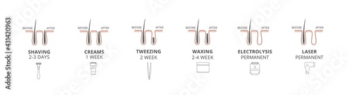 Hair removal methods - laser and shaving, creams and tweezing, waxing and electrolysis. Procedure of beauty before and after effects for skin body. Set of vector illustrations.