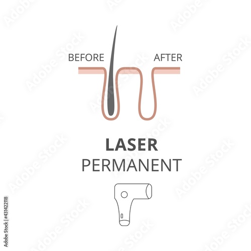 Tweezing body hair removal or epilation method, flat vector illustration.