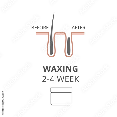 Hair removal wax, depilation epilation before and after a vector illustration.