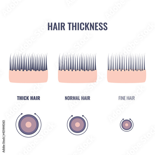 Hair thickness types classification set. Skin cross-section with fine, normal, thick strands. Anatomical structure linear scheme. Outline vector illustration.