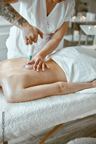 professional female specialist is doing cupping therapy on the back of beautiful caucasian lady photo