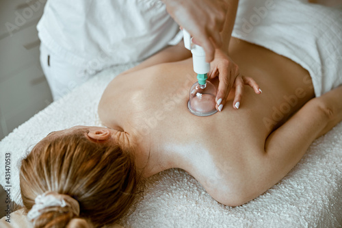 professional female specialist is doing cupping therapy on the back of beautiful caucasian lady photo