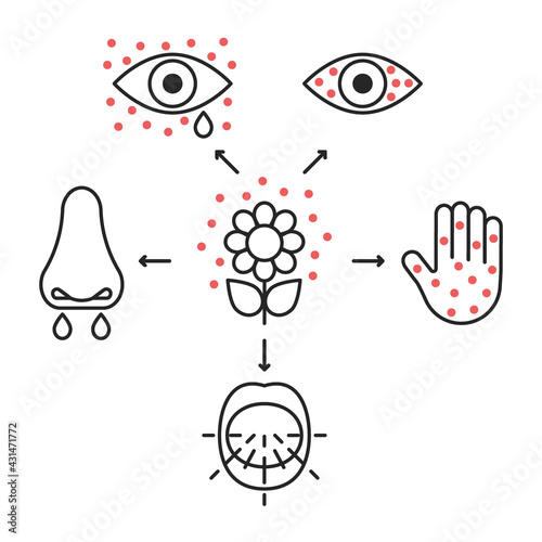 Allergy symptoms line icons, irritation organs senses. Inflammation of eyes, lacrimation, sneeze, blisters on skin, runny nose. Vector sign infographic illustration