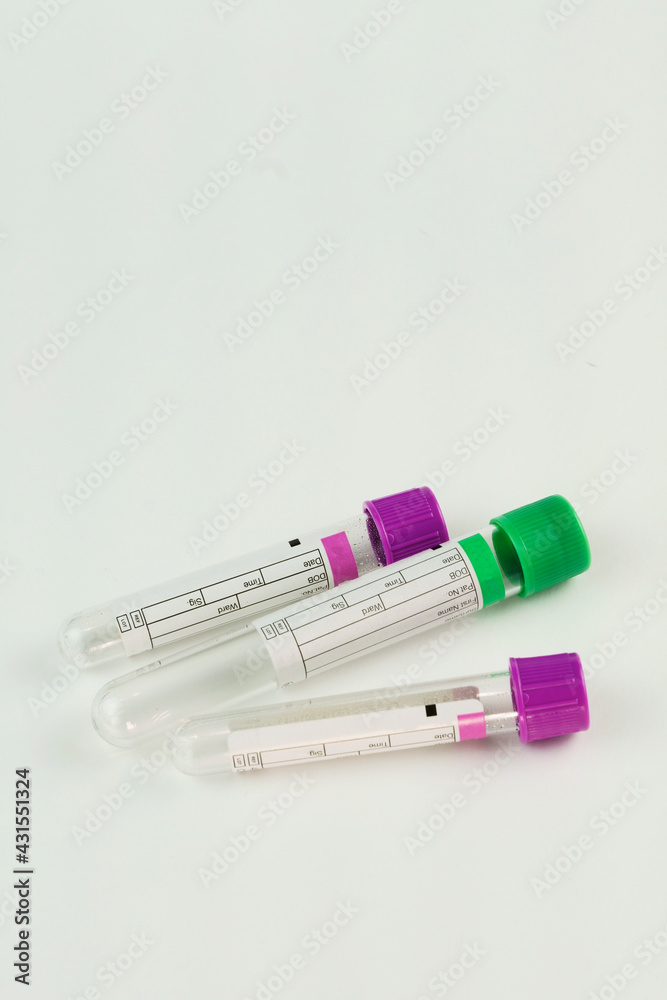 vacuum tubes for collection and blood samples on white background..Transparent with purple and green lid. Label to identify the data. Selective focus. vacuum tubes for collection and blood samples on white background..Transparent with purple and green lid. Label to identify the data. Selective focus.
