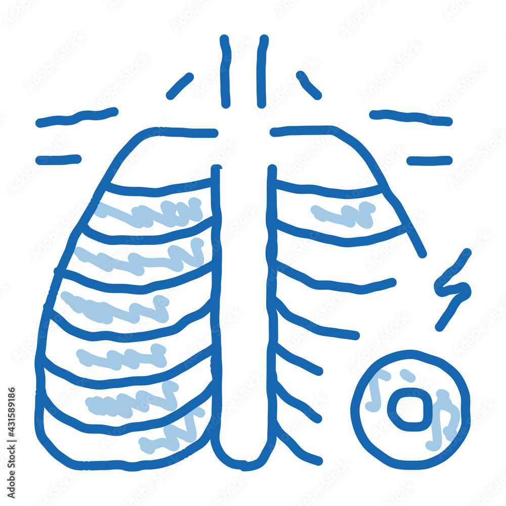 arthritis of rib-sternum joint doodle icon hand drawn illustration arthritis of rib-sternum joint doodle icon hand drawn illustration
