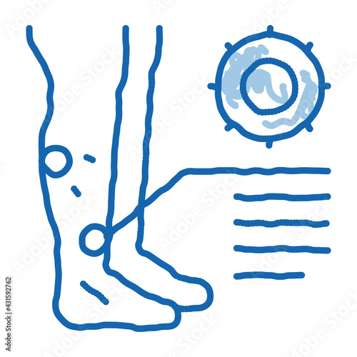 rash dermatitis on legs doodle icon hand drawn illustration