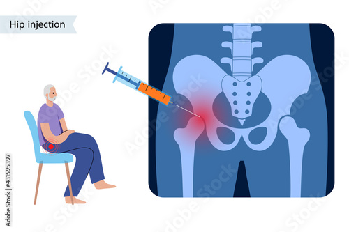 Hip joint injection photo