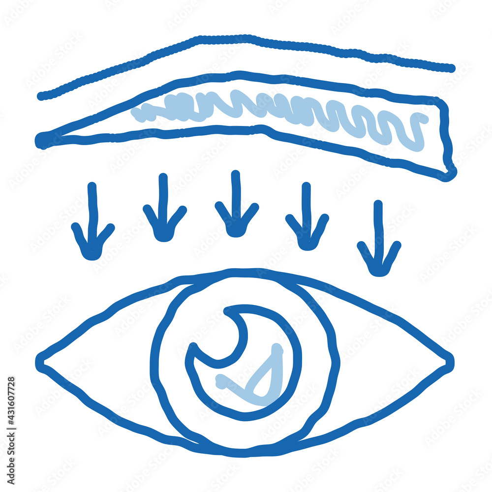 Fototapeta premium eyebrow down surgery doodle icon hand drawn illustration