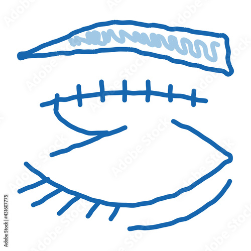 eyelid surgery stitching doodle icon hand drawn illustration