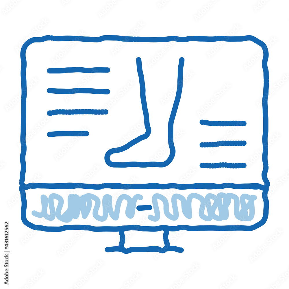 symptomps varicose veins web site doodle icon hand drawn illustration symptomps varicose veins web site doodle icon hand drawn illustration