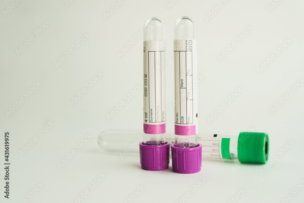 vacuum tubes for collection and blood samples on white background..Transparent with purple and green lid. Label to identify the data. Selective focus. vacuum tubes for collection and blood samples on white background..Transparent with purple and green lid. Label to identify the data. Selective focus.