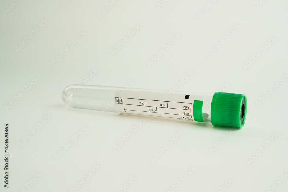vacuum tube for collection and blood samples on white background..Transparent with green lid. Label to identify the data. Selective focus. vacuum tube for collection and blood samples on white background..Transparent with green lid. Label to identify the data. Selective focus.