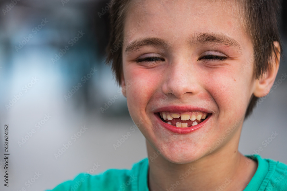 Portrait of a cheerful smiling boy on soft focus. Smile with changing milk teeth to Korean ones