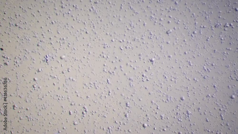 Breast Milk under a Microscope 01 Breast Milk under a Microscope 01
