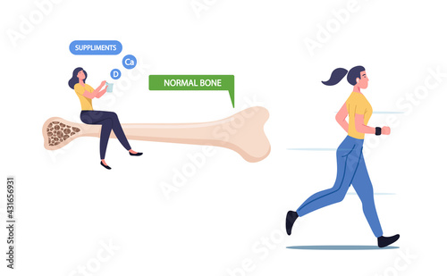 Osteoporosis Disease Prevention, Health Care Concept. Tiny Woman Sitting on Huge Healthy Bone with Normal Structure