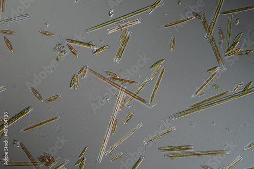 various diatoms photo