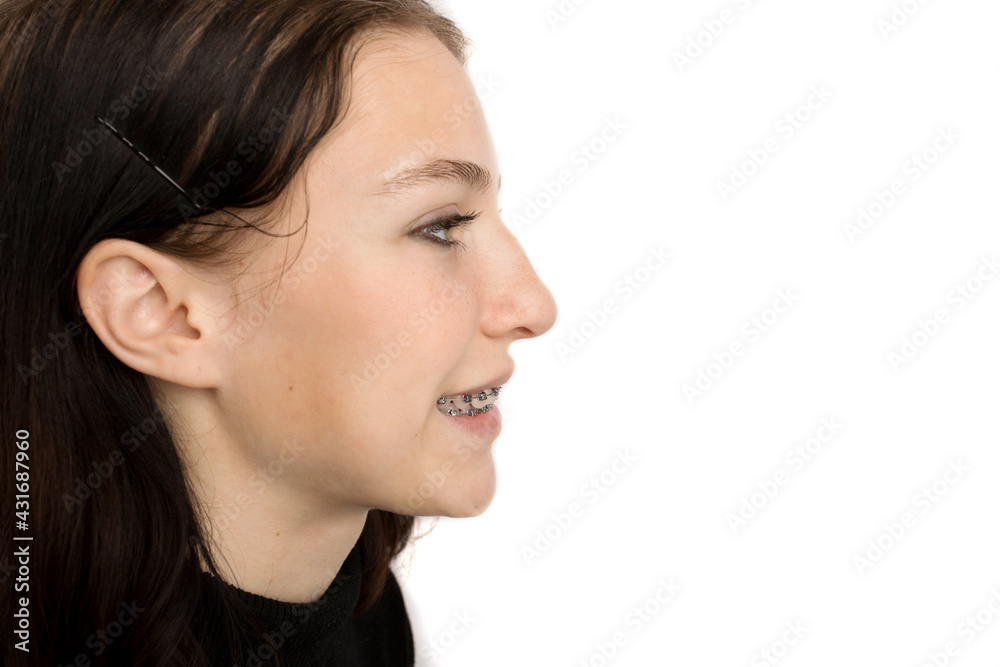 Orthodontic treatment. Dental care concept. Smiling teenage girl with braces. Metal braces close-up on the teeth. Orthodontic treatment. Dental care concept. Smiling teenage girl with braces. Metal braces close-up on the teeth.