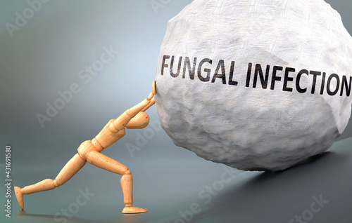 Fungal infection and painful human condition, pictured as a wooden human figure pushing heavy weight to show how hard it can be to deal with Fungal infection in human life, 3d illustration photo