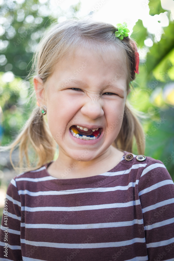 Child with a dental orthodontic device and without one tooth Child with a dental orthodontic device and without one tooth