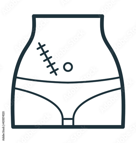 Appendix Surgery