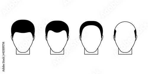 Male stage of baldness, alopecia top view. Hair loss problem of male. Hair fall. Vector flat illustration