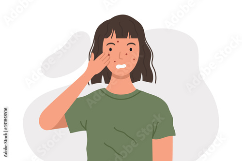 Woman with acne or allergy pimples touches her face. Young girl with skin problems. Skincare and dermatology concept.  Flat style vector illustration.
