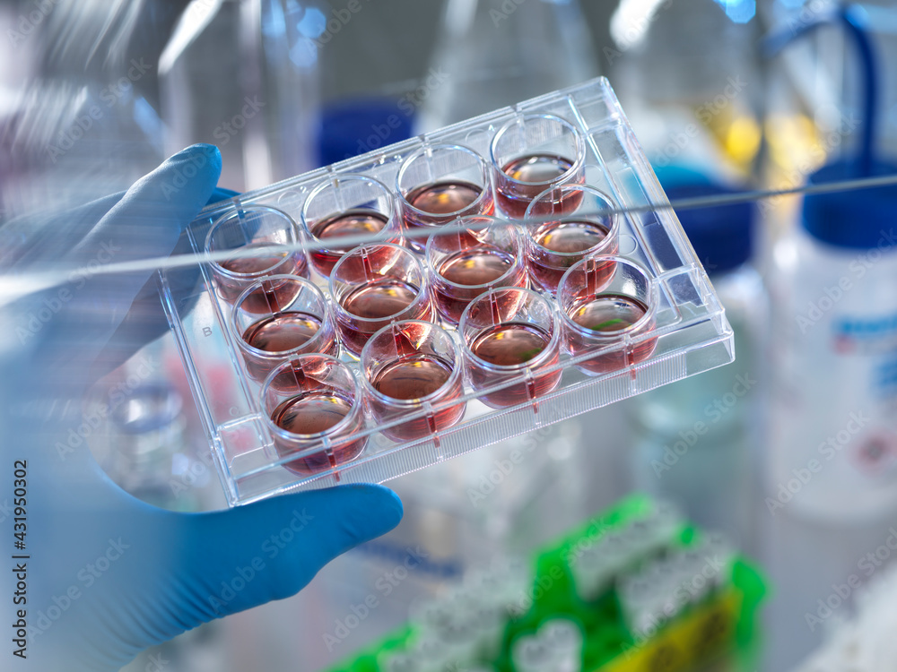 © Andrew Brookes/Westend61 - Scientist holding multi well plate with blood samples in laboratory