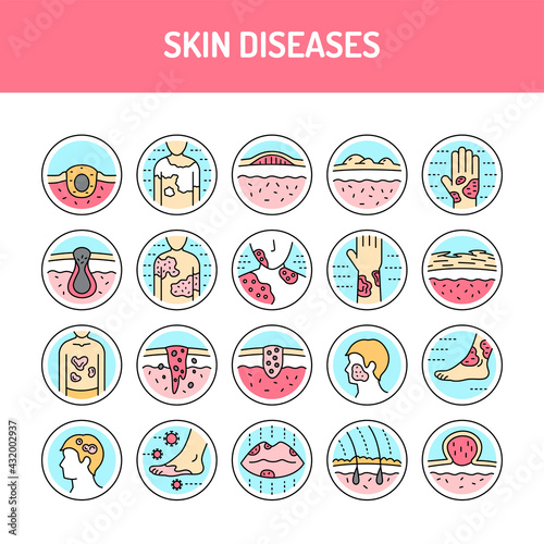Skin diseases line icons set. Isolated vector element.