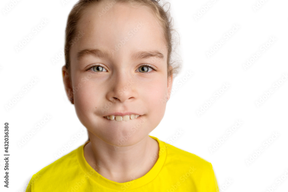 Little girl stands on a white background with a beautiful smile, children crooked teeth, pediatric dentistry. Crooked teeth close-up. Correction of malocclusion is required. Little girl stands on a white background with a beautiful smile, children crooked teeth, pediatric dentistry. Crooked teeth close-up. Correction of malocclusion is required.