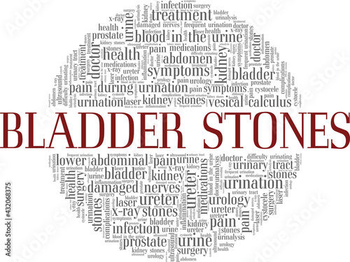 Bladder stones vector illustration word cloud isolated on a white background.