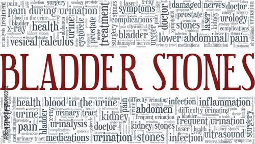 Bladder stones vector illustration word cloud isolated on a white background.