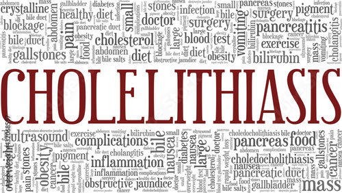 Cholelithiasis vector illustration word cloud isolated on a white background.