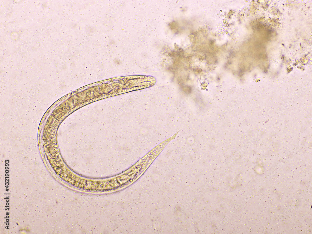 Strongyloides Stercoralis Or Threadworm In Human Stool Analyze By Microscope Original 3320