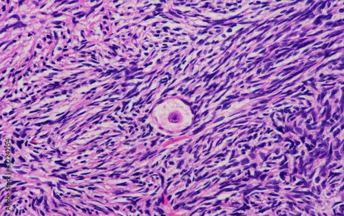 A single egg cell inside a woman's ovary surrounded by supporting cells. Microscopic view.