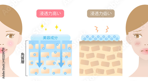 浸透力の高い肌と低い肌　女性と断面図