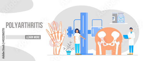 Rheumatoid arthritis of the foot. Tiny doctors treat rheumatism, osteoarthritis, make ultrasound, x ray. World arthritis day in October. Flat concept vector for landing page, banner