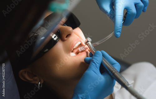 First person close-up shot of a dentist treating teeth of a young woman. The doctor drilling the teeth to eliminate caries and place a filling after.