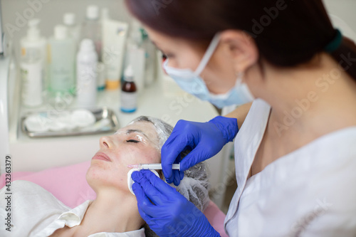 Skin biorevitalization  nutrition and moisturizing therapy.Beautiful woman at the dermatology clinic. Cosmetologist doing injections on the face and mouth area of female client